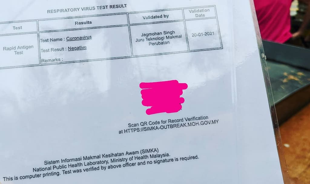 COVID-19 test result